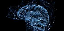 Brain Health MRI image