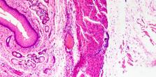 Skin Senescence article
