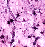 A Witch's Brew of of Pro-inflammatory Molecules image