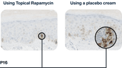 Senescence Clearance
