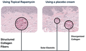 Cell Restoration from Sun Damage